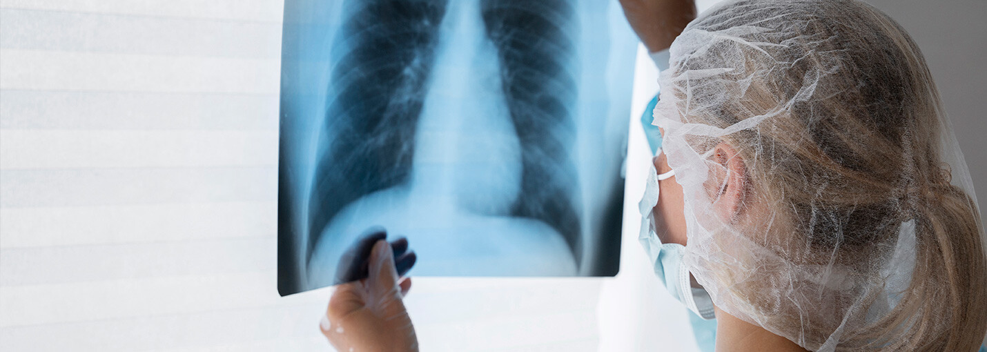Image Asbestos Emphysema article body